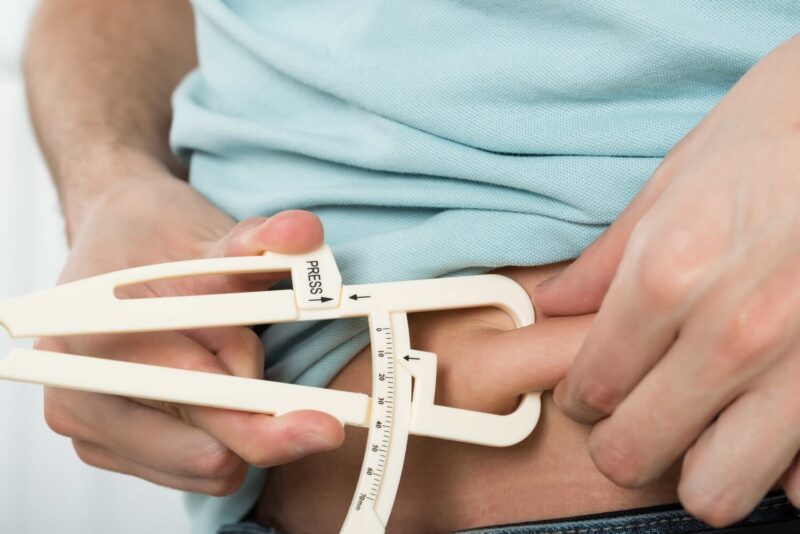 Bariatric Surgery