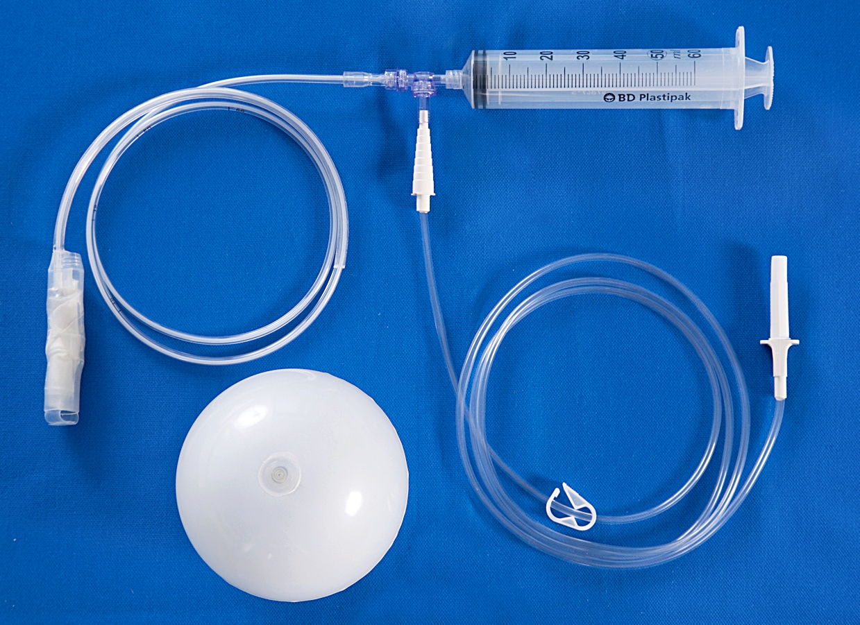 Magenballon-Set gastric balloon cost turkey antalya