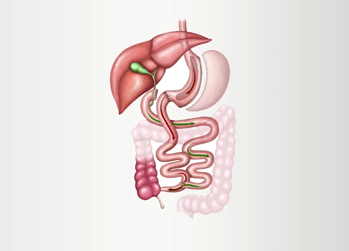 Understanding Transit Bipartition: A Comprehensive Guide